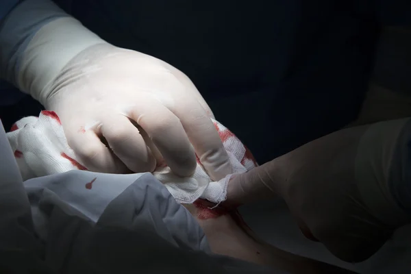 La mano del chirurgo nel guanto — Foto Stock