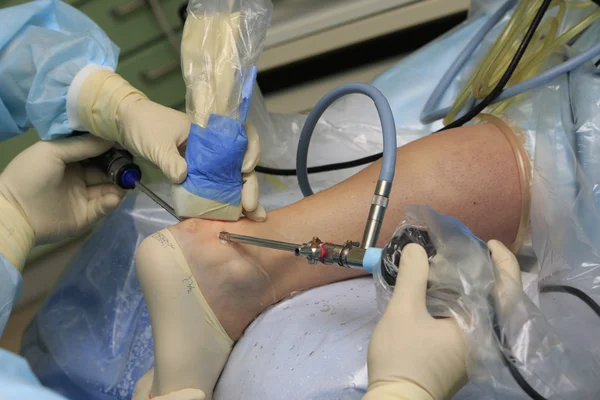 Bacak Laparoskopik cerrahi