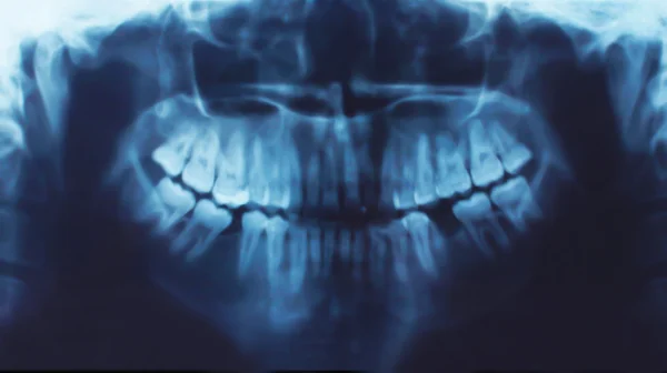 RTG zębów, Stomatologia koncepcja — Zdjęcie stockowe