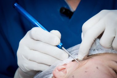 Kozmetik, enjeksiyon, plastik cerrahi yüz