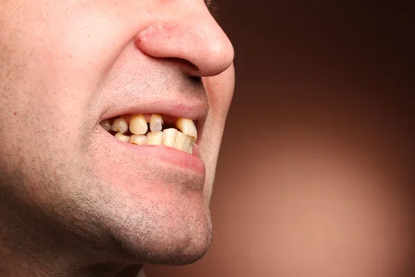 Кривые зубы фото