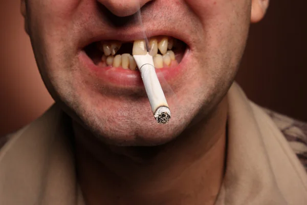 Bad teeth smoker — Stock Photo, Image