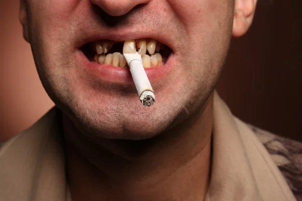 खराब दात धूम्रपान करणारा — स्टॉक फोटो, इमेज