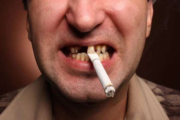 Bad teeth smoker — Stock Photo, Image