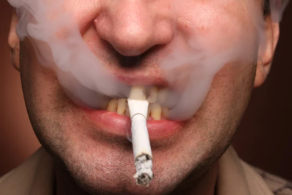 Bad teeth smoker — Stock Photo, Image