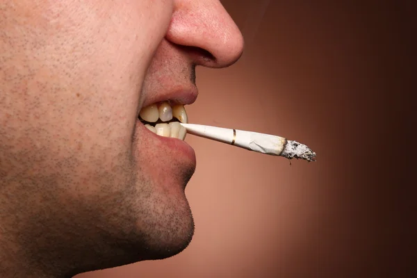 Raucher mit schlechten Zähnen — Stockfoto