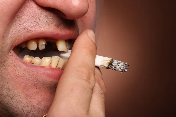 Slechte tanden roker — Stockfoto