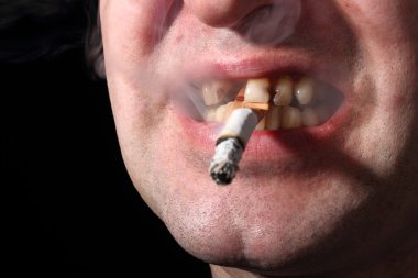 Kötü diş sigara içen