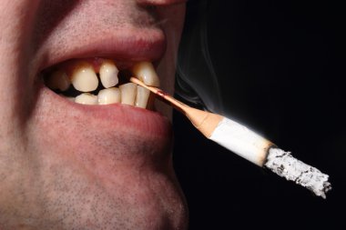 Kötü diş sigara içen