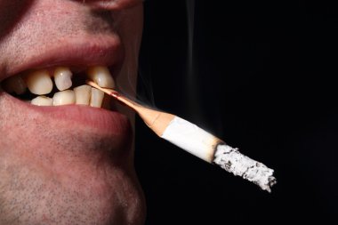 Kötü diş sigara içen