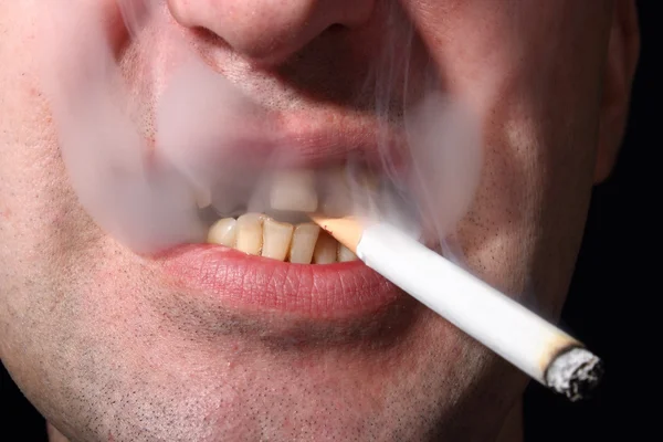 Bad teeth smoker — Stock Photo, Image