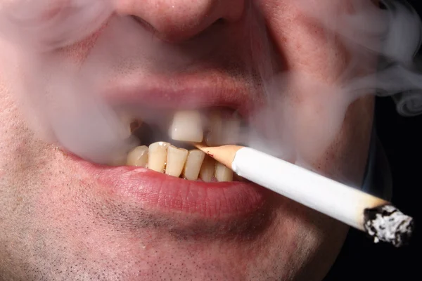 Kötü diş sigara içen