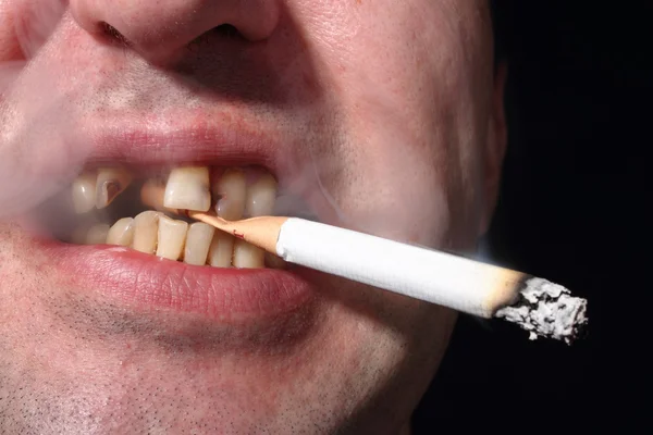 Dåliga tänder rökare — Stockfoto