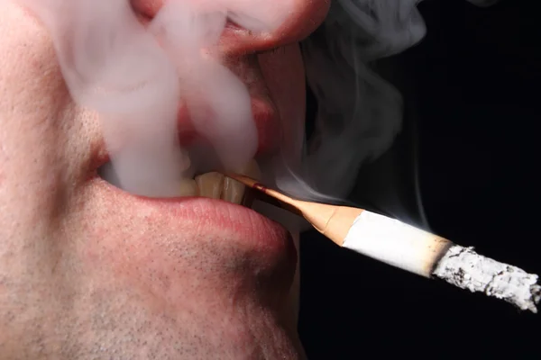 Kötü diş sigara içen