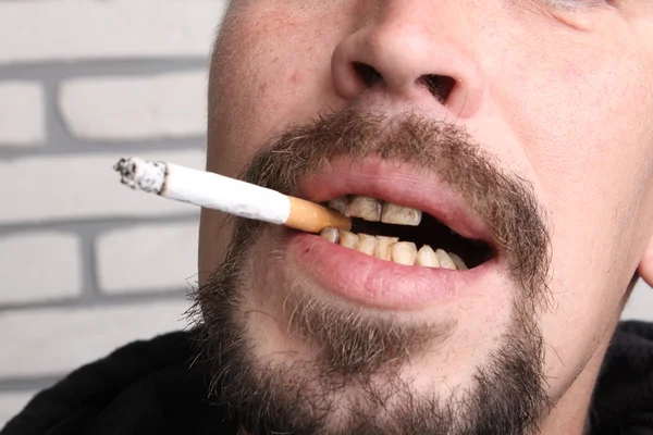Bad teeth smoker sick — Stock Photo, Image