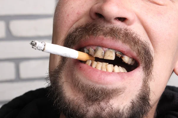 Dåliga tänder rökare sjukt — Stockfoto
