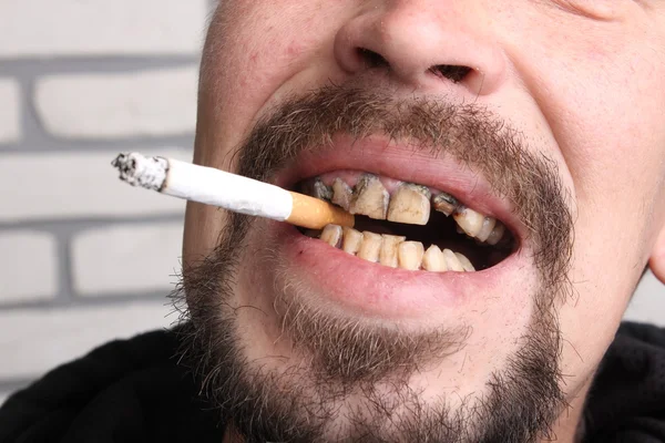 Bad teeth smoker sick — Stock Photo, Image