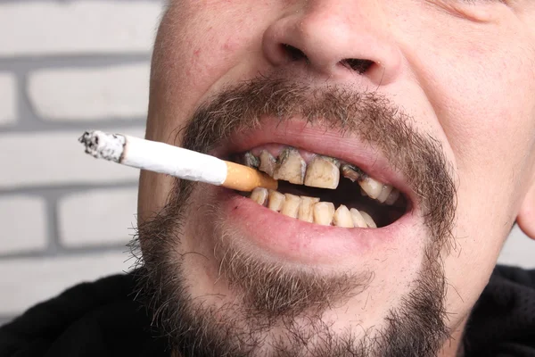 Bad teeth smoker sick — Stock Photo, Image