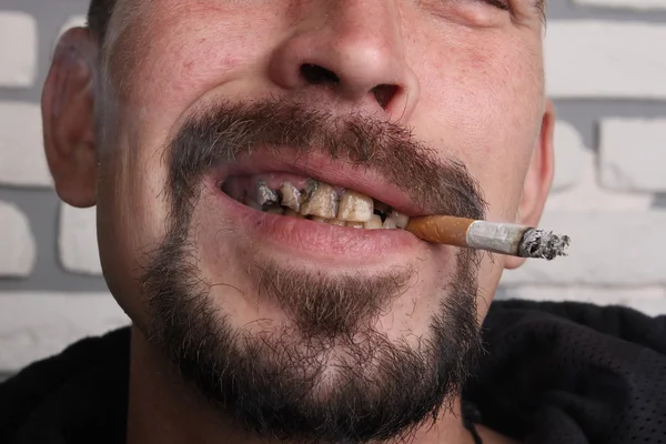 Maus dentes fumante doente — Fotografia de Stock
