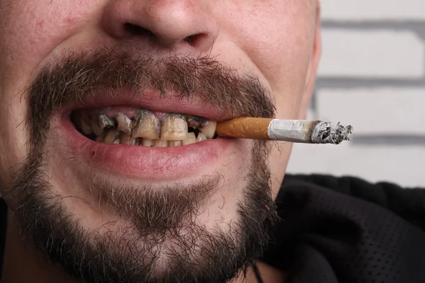 Bad teeth smoker sick — Stock Photo, Image