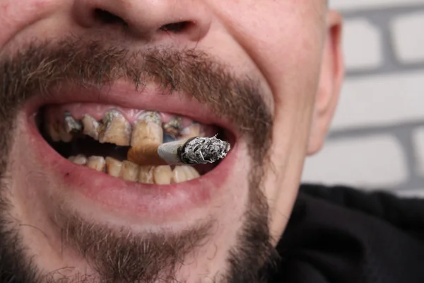 Schlechte Zähne Raucher krank lizenzfreie Stockfotos