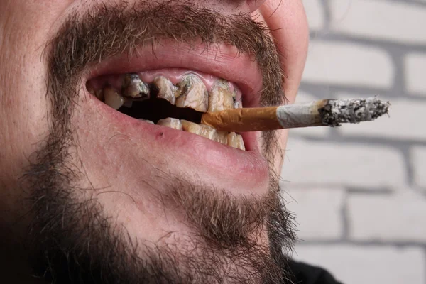 Schlechte Zähne Raucher krank Stockbild