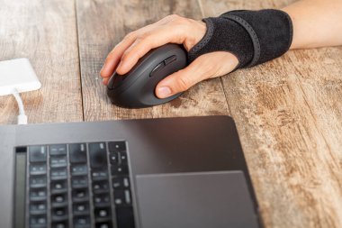 Chronic trauma to the wrist joint  in people using computer mouse may lead to disorders that cause inflammation and pain. A woman working on desk uses wrist support brace and ergonomic vertical mouse clipart