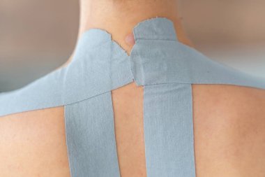 Bir kadının boyun ve omuz bölgesine uygulanan kineziyoloji bandının yakın görüntüsü. Modern rehabilitasyon teknikleriyle fizik tedavi ve kas desteği. Yüksek kalite fotoğraf