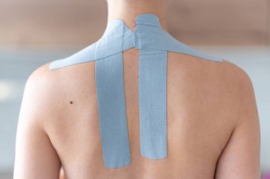 Bir kadının boyun ve omuz bölgesine uygulanan kineziyoloji bandının yakın görüntüsü. Modern rehabilitasyon teknikleriyle fizik tedavi ve kas desteği. Yüksek kalite fotoğraf