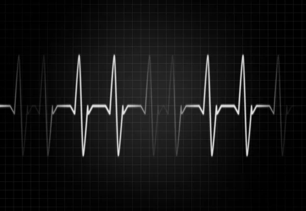 A fehér színű szív frekvencia — Stock Fotó
