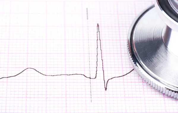 Stetoskop och EKG — Stockfoto