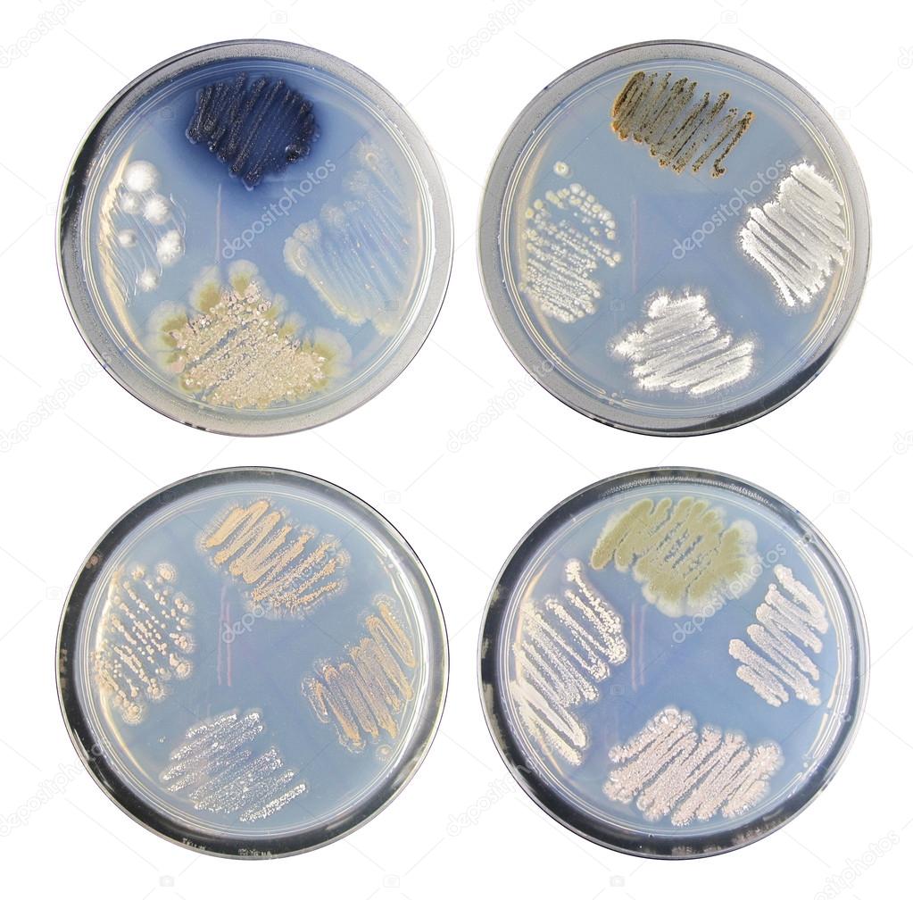Set of varity colony bacteria (actinomycetes) morphology on agar