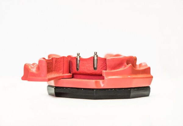 Зубные протезы, изолированные на белом
