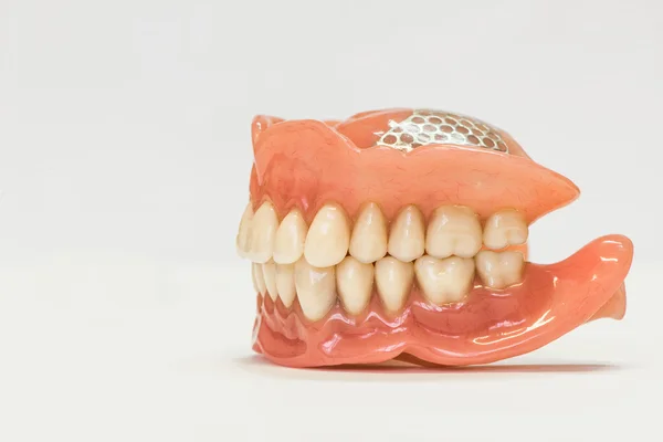 Prótesis dentales aisladas en blanco — Foto de Stock