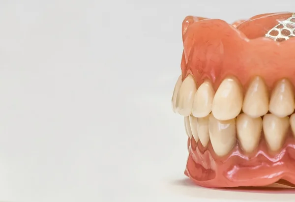 Diş Protez üzerinde beyaz izole — Stok fotoğraf