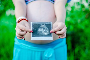 Mutlu hamile kadınlar açık bahçede