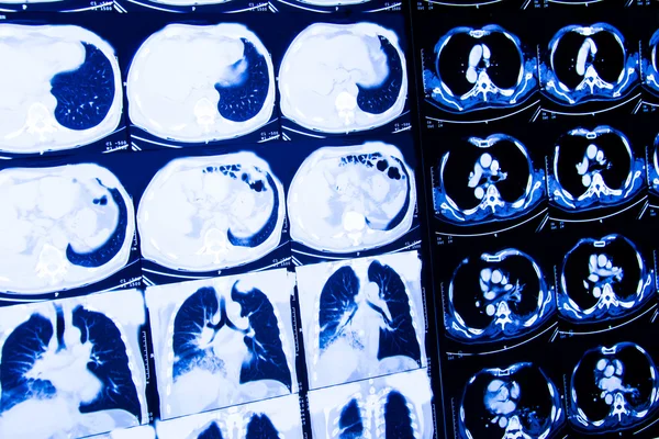 Recherche en médecine. CT scan du patient . — Photo