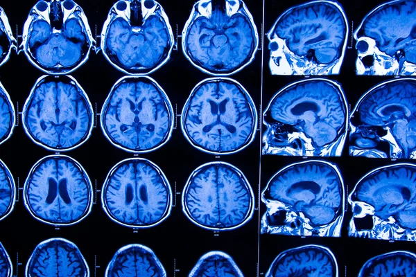 Araştırma tıp. CT taraması hastanın.