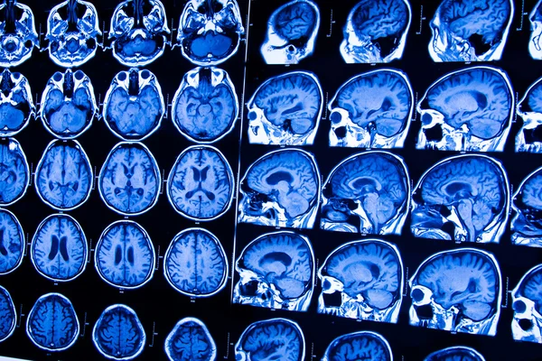 Araştırma tıp. CT taraması hastanın.