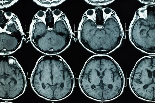 Araştırma tıp. CT taraması hastanın.