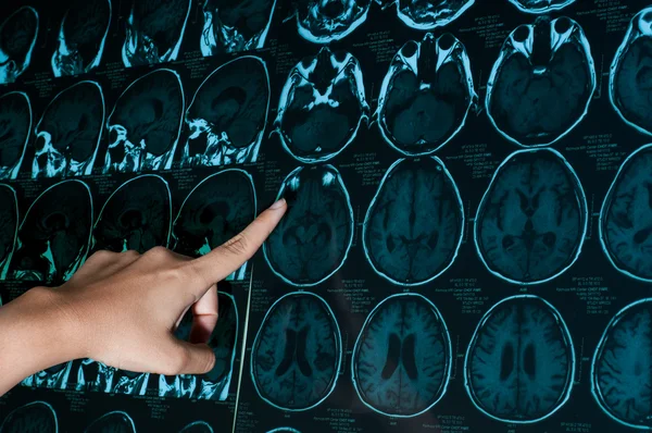 Araştırma tıp. CT taraması hastanın.