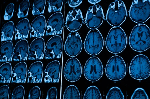 医学の研究。患者の ct スキャン. — ストック写真