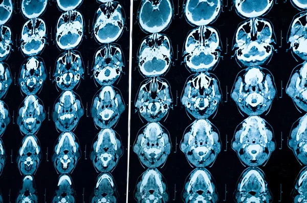 Araştırma tıp. CT taraması hastanın.