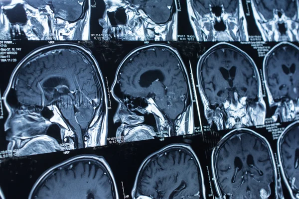 Araştırma tıp. CT taraması hastanın.