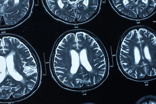 Araştırma tıp. CT taraması hastanın.