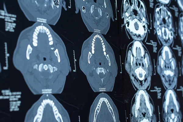 Araştırma tıp. CT taraması hastanın.