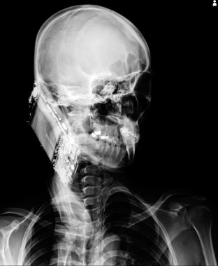 X-ray picture of the skull clipart