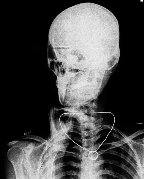 X-ray picture of the skull — Stock Photo, Image