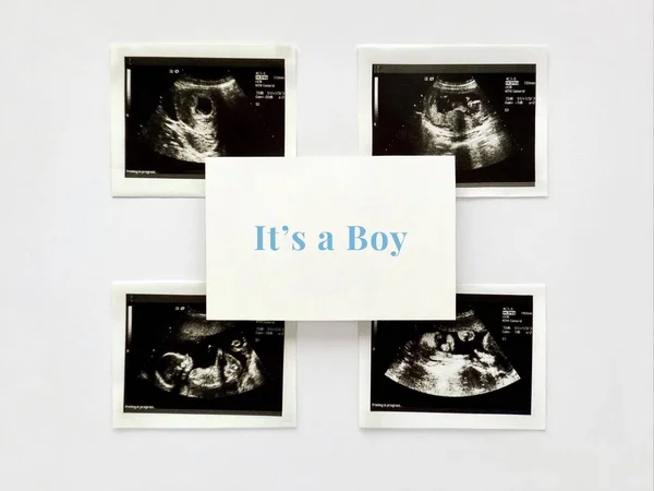 妊娠中の女性の超音波スキャン テキストと白い紙その少年 — ストック写真
