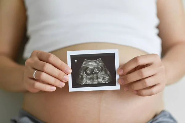 Stock image Close up Pregnant woman holding ultrasound scan photo on her belly. Mother with sonogram of her unborn baby. Concept of pregnancy, Maternity prenatal care